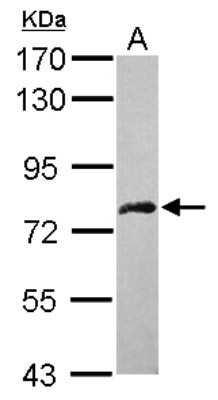 Western Blot: DDX59 Antibody [NBP2-16142]