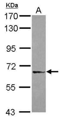 Western Blot: DDX59 Antibody [NBP2-16143]