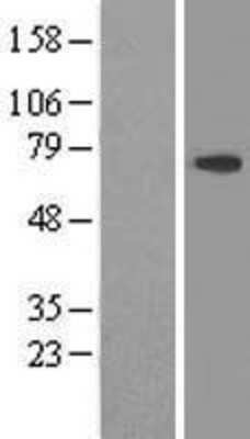 Western Blot: DDX59 Overexpression Lysate [NBL1-09809]