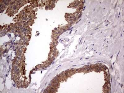 Immunohistochemistry: DDX6 Antibody (OTI2D6) [NBP2-46448]