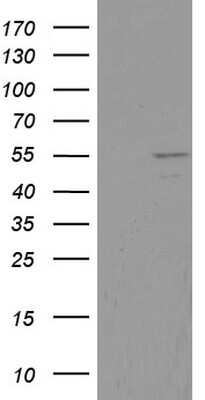 Western Blot: DDX6 Antibody (OTI2D6) [NBP2-46448]