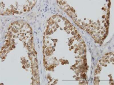 Immunohistochemistry-Paraffin: DDX6 Antibody (3D2) [H00001656-M01]