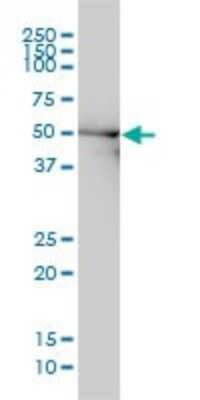 Western Blot: DDX6 Antibody (3D2) [H00001656-M01]