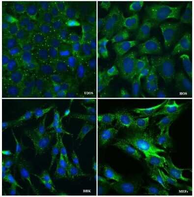 Immunocytochemistry/ Immunofluorescence: DDX6 Antibody [NB200-191]