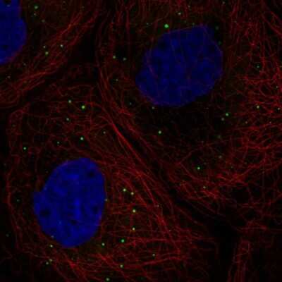 Immunocytochemistry/ Immunofluorescence: DDX6 Antibody [NBP1-83249]