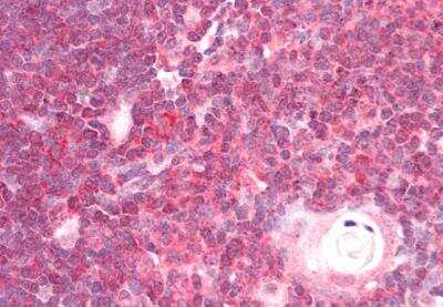 Immunohistochemistry-Paraffin: DDX6 Antibody [NB100-2818]