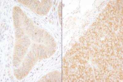 Immunohistochemistry-Paraffin: DDX6 Antibody [NB200-191]
