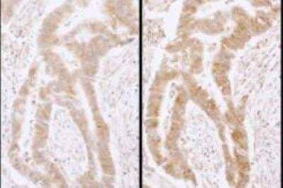 Immunohistochemistry-Paraffin: DDX6 Antibody [NB200-192]
