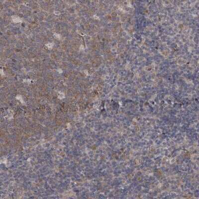 Immunohistochemistry-Paraffin: DDX6 Antibody [NBP1-83248]