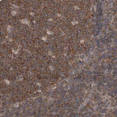 Immunohistochemistry-Paraffin: DDX6 Antibody [NBP1-83249]