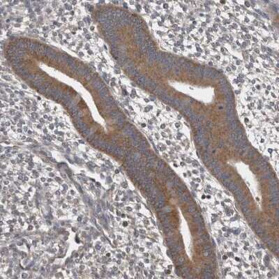 Immunohistochemistry-Paraffin: DDX6 Antibody [NBP1-83249]