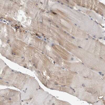 Immunohistochemistry-Paraffin: DDX6 Antibody [NBP1-83249]