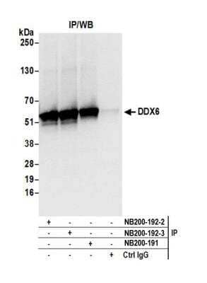 Immunoprecipitation: DDX6 Antibody [NB200-192]