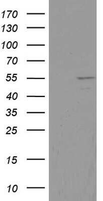 Western Blot: DDX6 Antibody (OTI2D6)Azide and BSA Free [NBP2-70563]