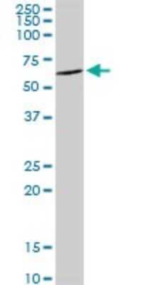 Western Blot: DDX6 Antibody [H00001656-D01P]