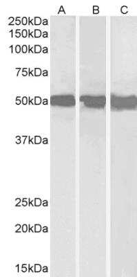 Western Blot: DDX6 Antibody [NB100-2818]