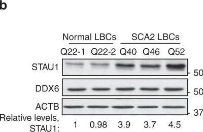 Western Blot: DDX6 Antibody [NB200-191]