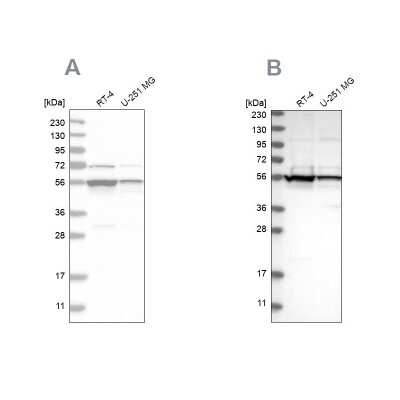 Western Blot: DDX6 Antibody [NBP1-83248]