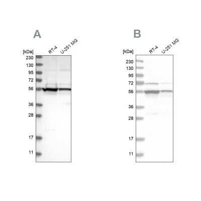 Western Blot: DDX6 Antibody [NBP1-83249]