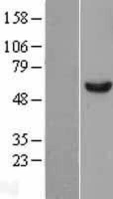 Western Blot: DDX6 Overexpression Lysate [NBL1-09810]