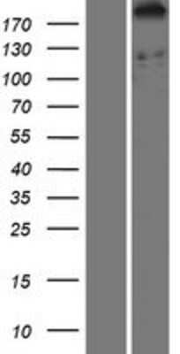 Western Blot: DDX60 Overexpression Lysate [NBP2-06948]