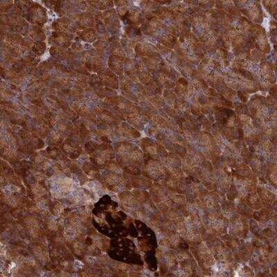 Immunohistochemistry-Paraffin: DDX60L Antibody [NBP1-93889]