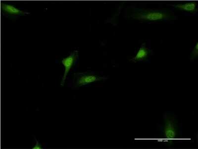Immunocytochemistry/ Immunofluorescence: DEAF1 Antibody (2A2) [H00010522-M07]