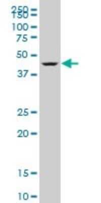 Western Blot: DEAF1 Antibody (3E6) [H00010522-M06]