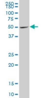 Western Blot: DEAF1 Antibody (3F11) [H00010522-M05]