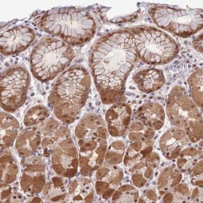 Immunohistochemistry-Paraffin: DEAF1 Antibody [NBP2-47489]