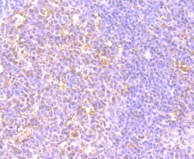 Immunohistochemistry-Paraffin: DEC-205/CD205 Antibody (JB87-35) [NBP2-75467]