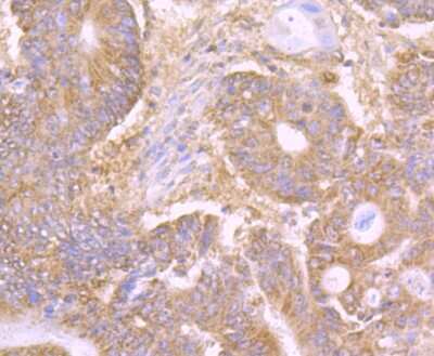 Immunohistochemistry-Paraffin: DEC-205/CD205 Antibody (JB87-35) [NBP2-75467]