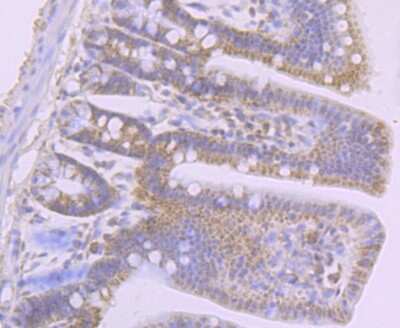 Immunohistochemistry-Paraffin: DEC-205/CD205 Antibody (JB87-35) [NBP2-75467]