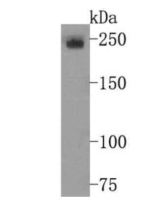 Western Blot: DEC-205/CD205 Antibody (JB87-35) [NBP2-75467]