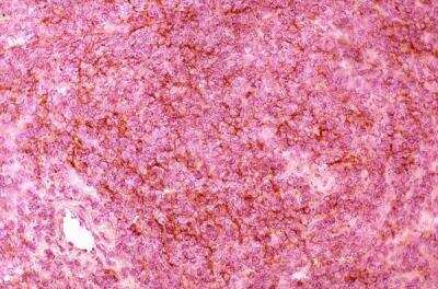 Immunohistochemistry: DEC-205/CD205 Antibody (NLDC-145) [DDX0020P-100]