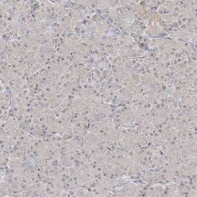 Immunohistochemistry: DEC1 Antibody [NBP2-47488]