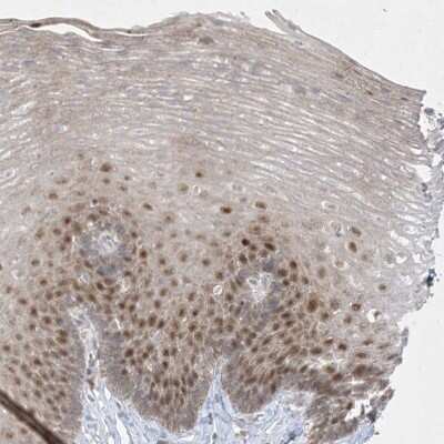 Immunohistochemistry-Paraffin: DEC1 Antibody [NBP2-47488]