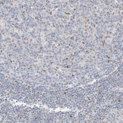 Immunohistochemistry-Paraffin: DEC1 Antibody [NBP2-47488]