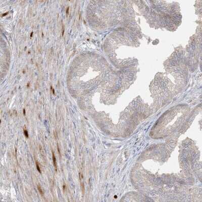 Immunohistochemistry-Paraffin: DEC1 Antibody [NBP2-47488]