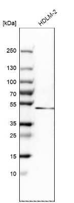 Western Blot: DEC1 Antibody [NBP2-47488]