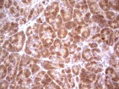 Immunohistochemistry: DEC2/SHARP1 Antibody (OTI5B1) [NBP2-46574]