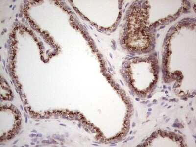 Immunohistochemistry: DEC2/SHARP1 Antibody (OTI5B1) [NBP2-46574]