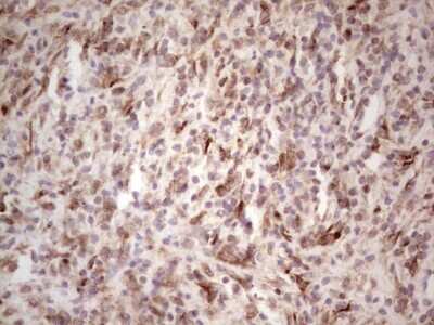 Immunohistochemistry: DEC2/SHARP1 Antibody (OTI5B1) [NBP2-46574]
