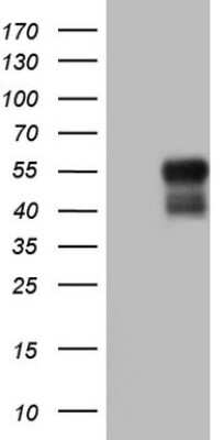 Western Blot: DEC2/SHARP1 Antibody (OTI5B1) [NBP2-46574]