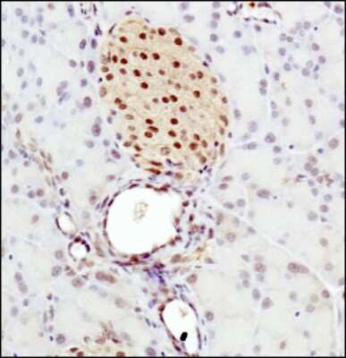 Immunohistochemistry-Paraffin: DEC2/SHARP1 Antibody - BSA Free [NBP1-19613]