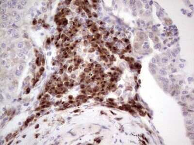 Immunohistochemistry: DEC2/SHARP1 Antibody (OTI5B1) - Azide and BSA Free [NBP2-72203]