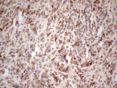 Immunohistochemistry: DEC2/SHARP1 Antibody (OTI5B1) - Azide and BSA Free [NBP2-72203]