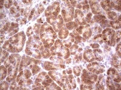 Immunohistochemistry: DEC2/SHARP1 Antibody (OTI5B1) - Azide and BSA Free [NBP2-72203]