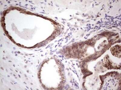 Immunohistochemistry: DEC2/SHARP1 Antibody (OTI5B1) - Azide and BSA Free [NBP2-72203]