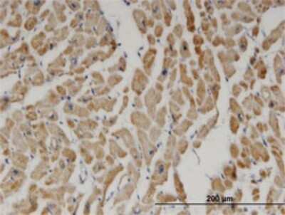 Immunohistochemistry-Paraffin: DECR1 Antibody (3D4) [H00001666-M01]